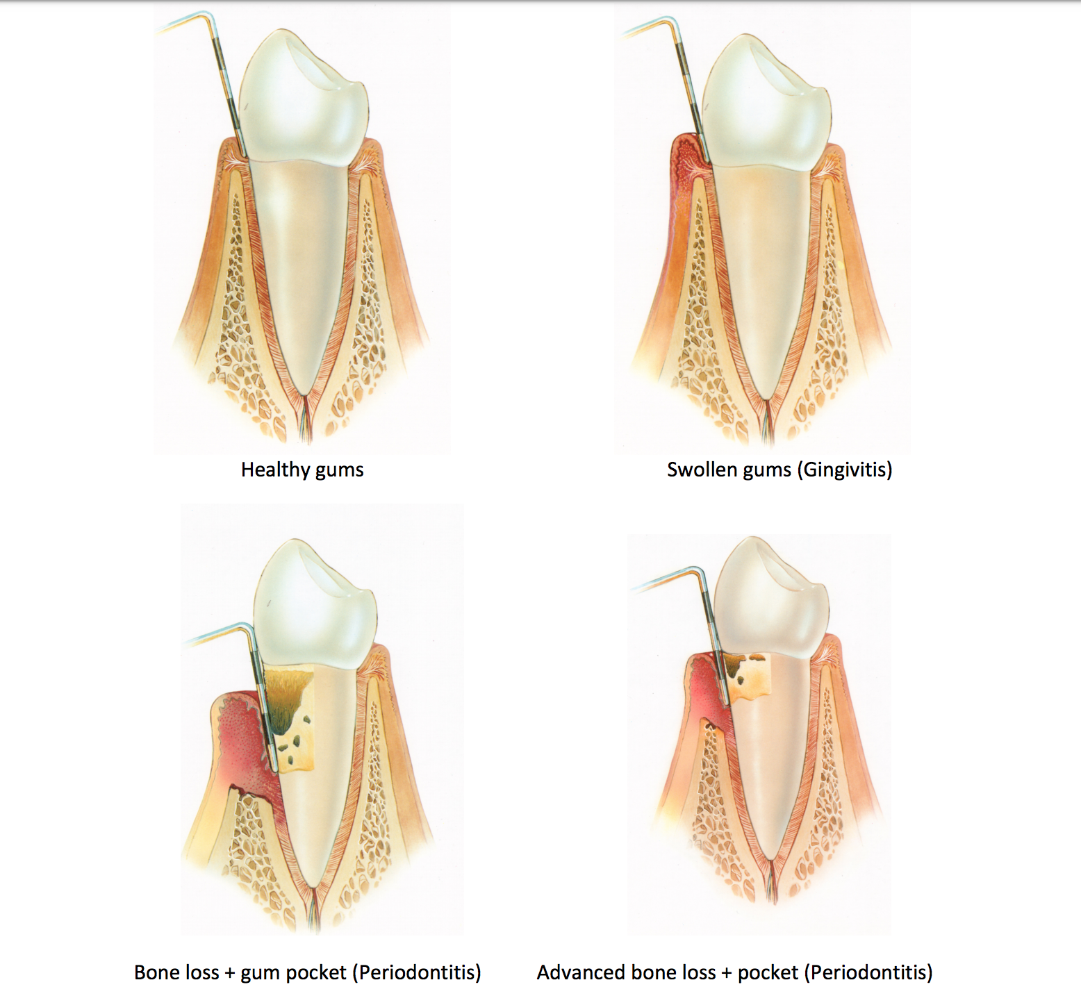 Periodontal Treatment